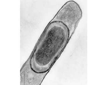 Клетка Bacillus licheniformis. Фото kenyon.edu