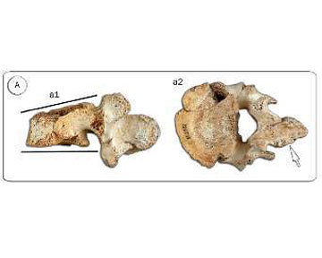 Авторы работы описали кости поясничного отдела позвоночника мужчины. Фото Newscientist.com