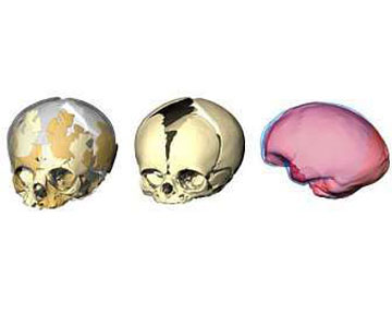 Авторы работы изучали строение мозга неандертальцев, анализируя кости черепа. Фото Мpg.de